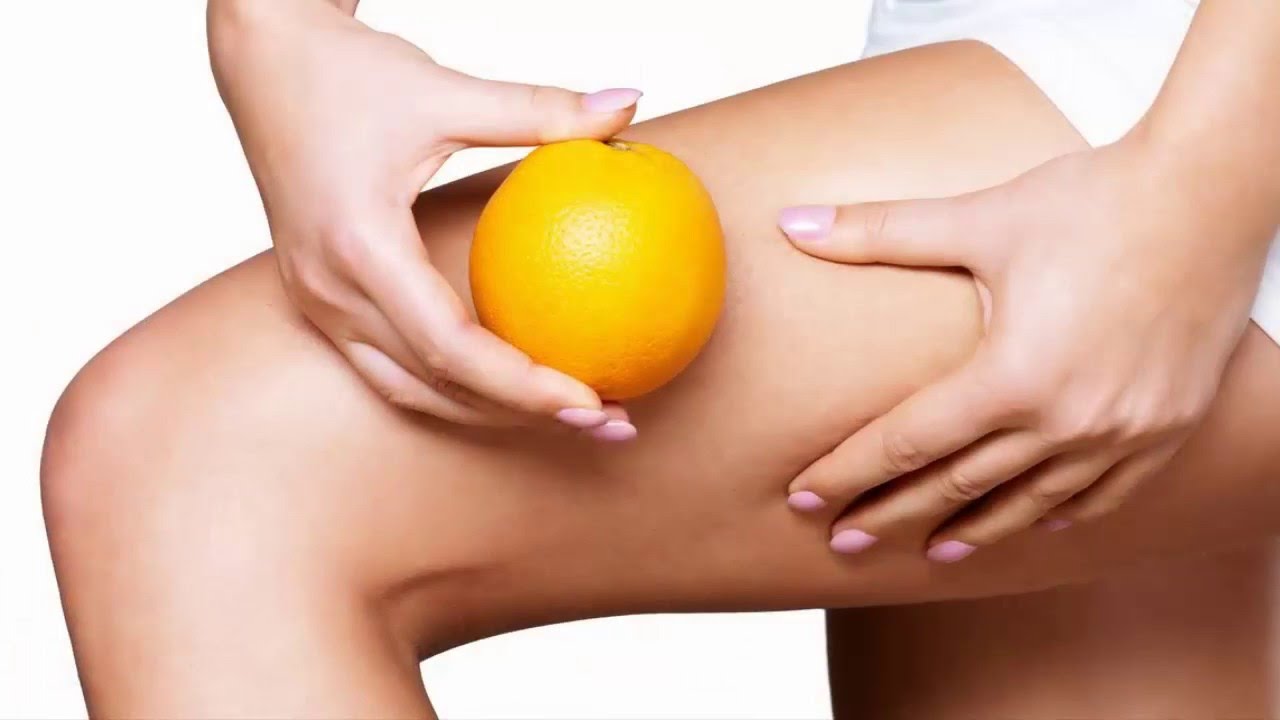 linfodrenaggio cellulite