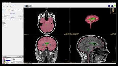 Analyze 14.0 - Measure: Sample Angles