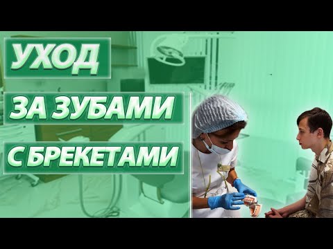 Как чистить зубы во время лечения на брекет системе? Брекеты. Ортодонтия и ортодонт в СОЧИ