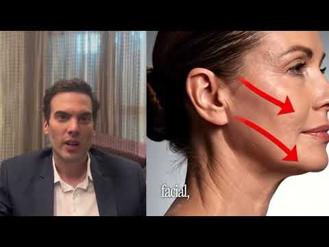 HarmonyCa: o que é e a diferença para Radiesse e Sculptra — vídeo do Dr. Thiago Perfeito