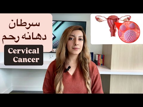 سرطان دهانه رحم علت علائم تشخیص درمان  