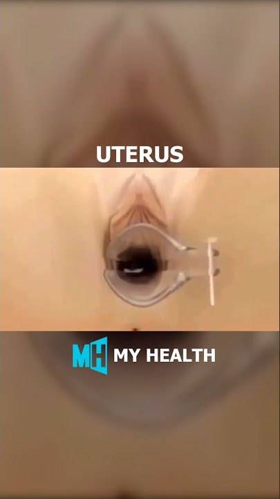 Insertion of a spiral into the vagina #vagina #uterus #uterusproblem #shorts #shortvideo #3d