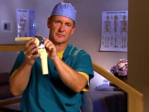 Total Knee Replacement Surgery