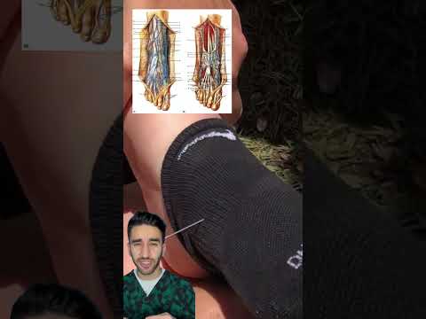 спица в ноге срочно скорая помощь