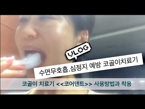 [쇼호스트 vlog] 코골이 수면무호흡 치료안하면 심정지.발기부전도 된다 수술없이 치료.기도확장기.수면무호흡증.코골이치료기 코어덴트 사용기 브이로그