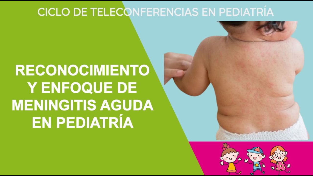 RECONOCIMIENTO Y ENFOQUE DE MENINGITIS AGUDA EN PEDIATRÍA