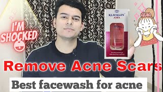 ?klm klin aha face wash review in hindi | glycolic acid face wash | klm klin face wash review |