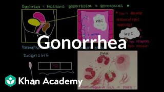 Pathophysiology, diagnosis, treatment, and prevention of gonorrhea | NCLEX-RN | Khan Academy