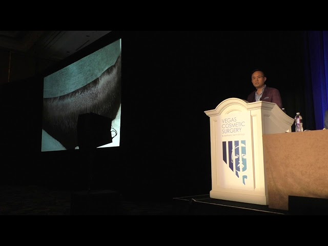 Dallas Hair Transplant Surgeon Dr. Sam Lam Lectures on PRP for Hair Loss in Las Vegas