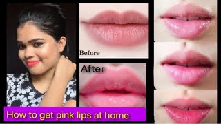How to Get Pink Lips naturally in tamil | How to get pink lips just 5 minutes | How to get pink Lips