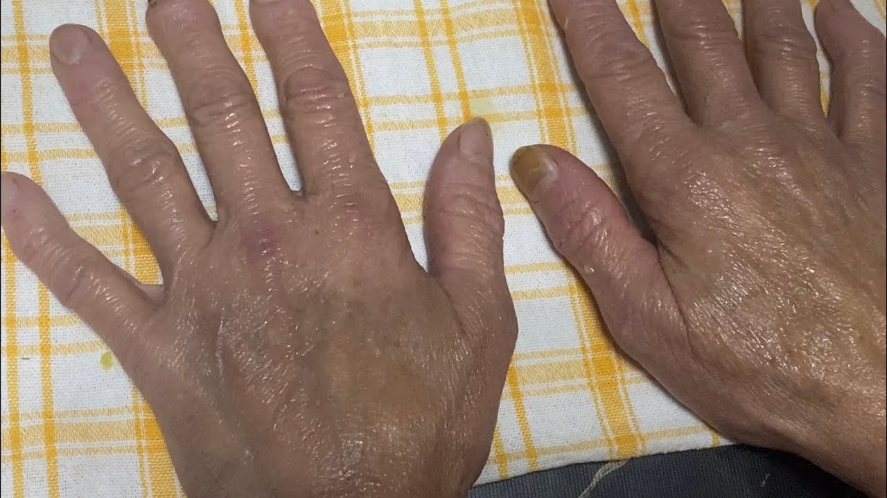 Para manos muy estropeadas,envejecidas y resecas, una crema casera que Para manos muy estropeadas,envejecidas y resecas, una crema casera que