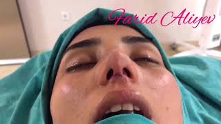 Rinoplastika (BURUN ESTETİK ƏMƏLİYYATI ) Dr. Farid Aliyev