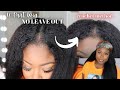 Upart Wig NO LEAVE OUT 🤯 | Kinky Straight YWigs