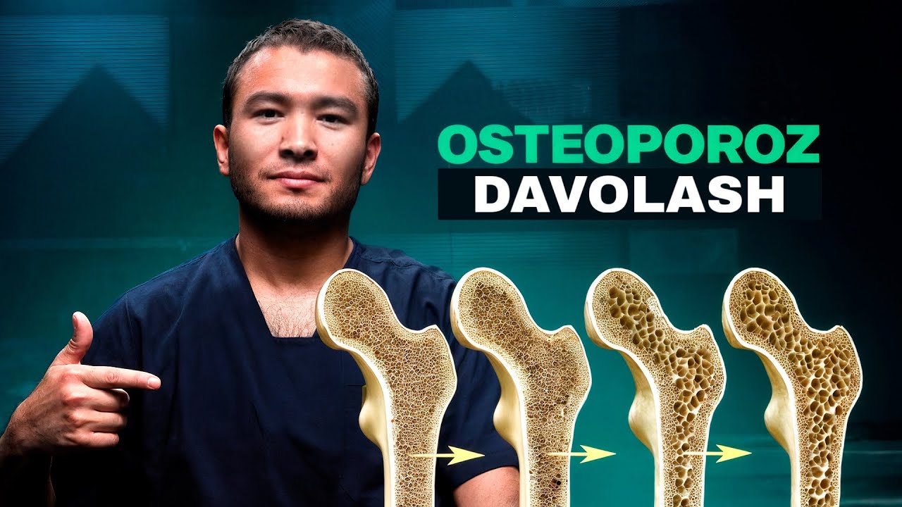 Остеопороз даволаш, суяк мўртлашишини даволаш, климаксдан кейинги суяк мўртлигини даволаш