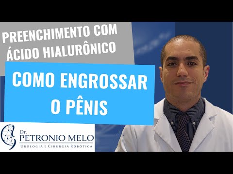 Vídeo: Quan fer exercici després de la cirurgia de laparotomia?