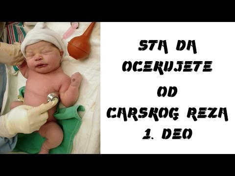 Video: Kakva Je Operacija Carskog Reza