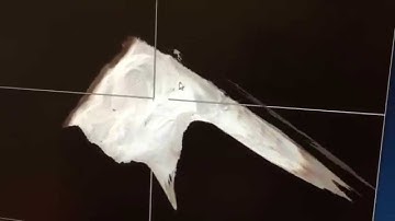 Kinect Calibration Error