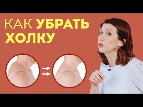 Как убрать ХОЛКУ на шее: эти простые упражнения и массаж уберут вдовий горб навсегда