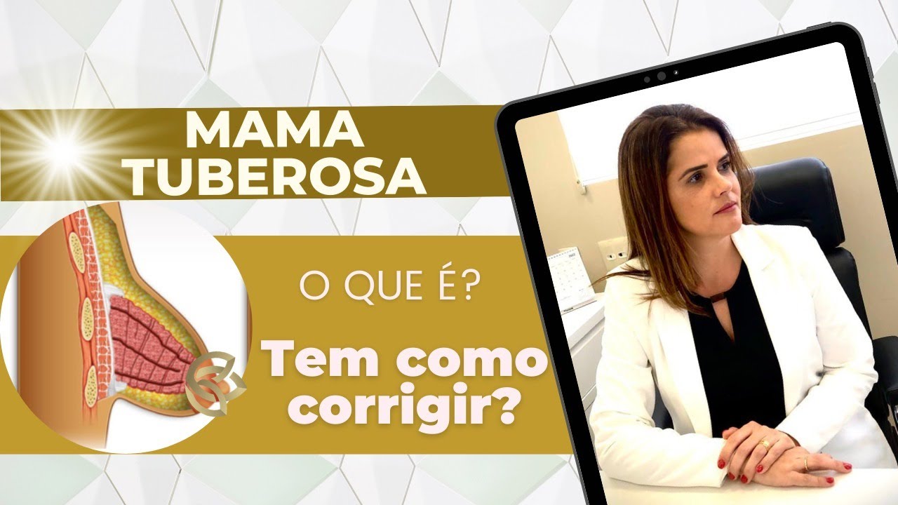 MAMA TUBEROSA O QUE É? QUAL
