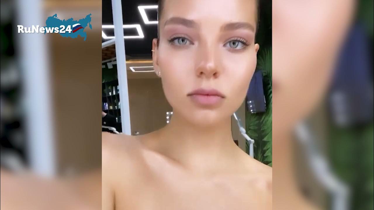 Леся кафельникова до пластики и после фото