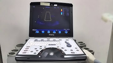 GE Vivid q Portable Ultrtasound (video 1).mp4