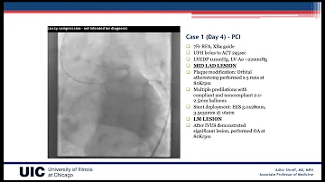 CVI 2020_0710_1200_Be Calculated: Optimizing Treatment COVID Recovery