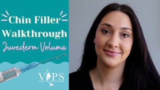 Juvederm Voluma: Chin Filler