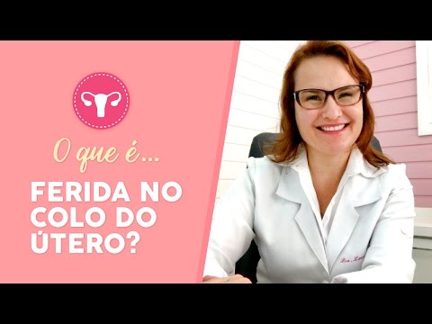 Vídeo: Colo Do útero Machucado: Dor, Sangramento E Outros Sintomas, Tratamento E Muito Mais