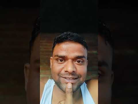 ambani hair loss