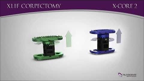 X Core II Animation (Japan)