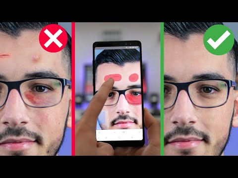 Vidéo: Comment Enlever L'acné Sur La Photo