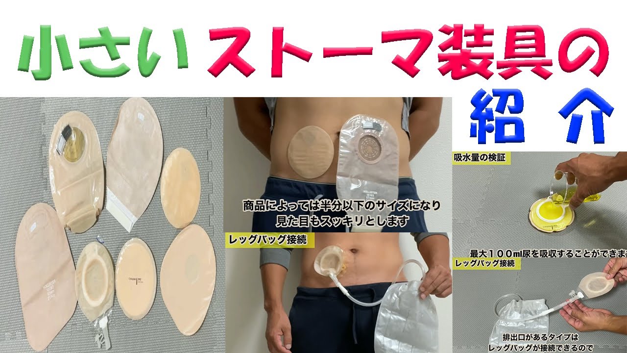 オストメイトの生活関連】小さいストーマ装具の紹介 - YouTube