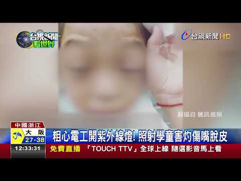 照5小時!教室誤開紫外線燈逾百學生眼灼傷