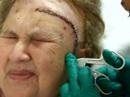 Jeanette tumor operation 2008