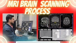 MRI Brain scanning process on siemens 1.5 tesla machine | MRI BRAIN WITH CISS sequence. screenshot 1