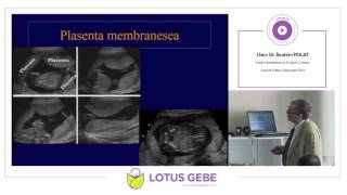UZM. DR. İBRAHİM POLAT - PLASENTA VE AMNİYOS DEĞERLENDİRİLMESİ