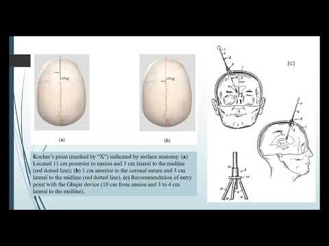 #3rd Topic, RESIDENT CLASS WEBINAR 2020. Neurotrauma Surgery and Neurotrauma Intensive Care