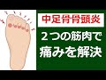 中足骨骨頭痛の治し方。2つの筋肉を緩める事で痛みを改善させる方法|足の悩み解消チャンネル