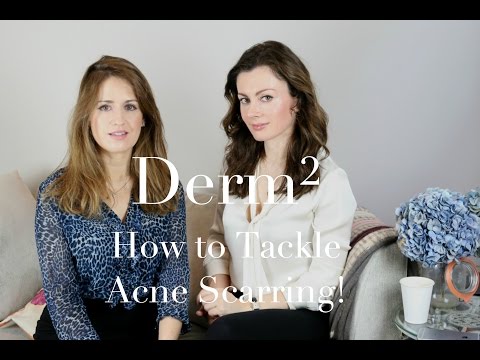 How to Tackle Acne Scarring! | DERMSquared | Dr Sam in The City