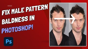 Easily Fix Male Pattern Baldness Using Photoshop CC
