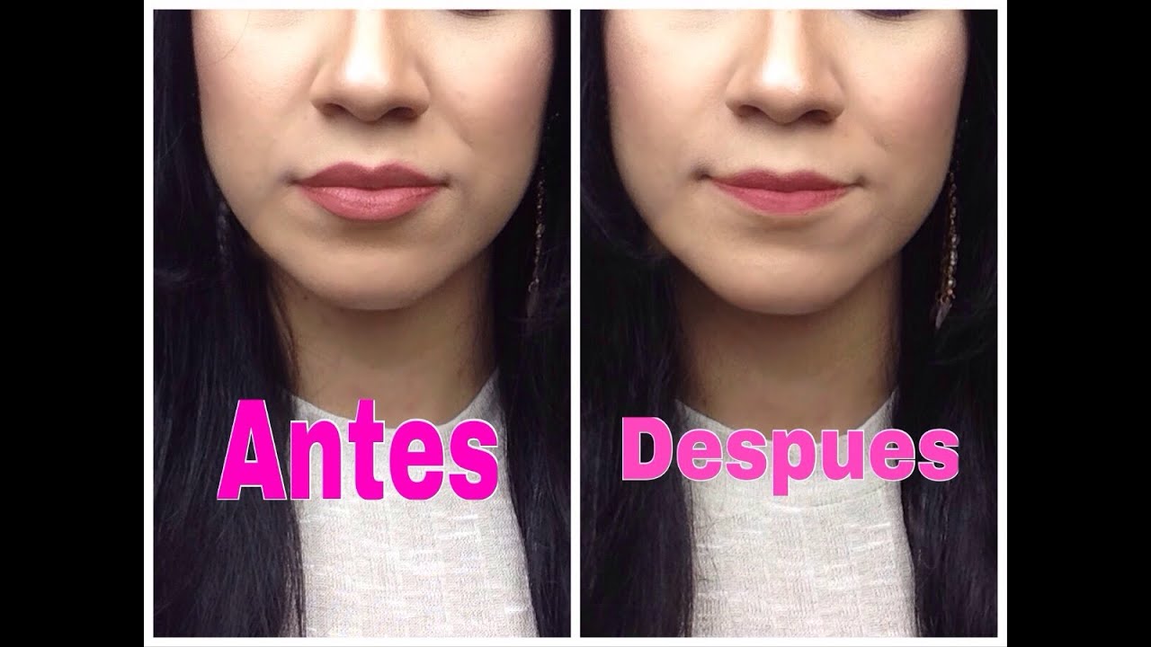 Como adelgazar los labios naturalmente Como adelgazar los labios naturalmente