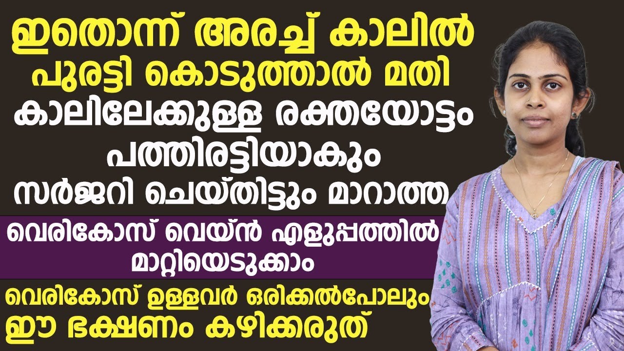 സർജറി ചെയ്തിട്ടും മാറാത്ത വെരികോസ് വെയ്ൻ മാറാൻ ഇത് പുരട്ടിയാൽ മതി |vericose vein malayalam