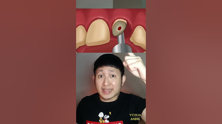 GIGI COWOK INI HANCUR DIMAKAN ULAT | Yosua Andre #alurcerita #shortvideo #shorts