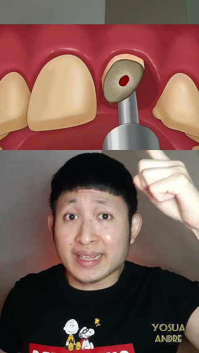 GIGI COWOK INI HANCUR DIMAKAN ULAT | Yosua Andre #alurcerita #shortvideo #shorts