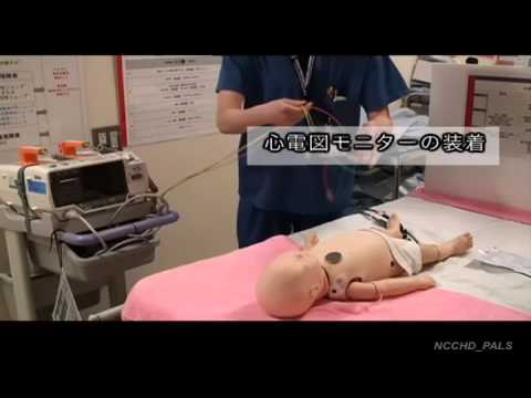 6-1. 除細動器の使い方 (PALS 小児救急初期診療) - YouTube