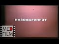 Назофарингит, гидроцефалия - лечение © Nasopharyngitis, hydrocephalus - treatment