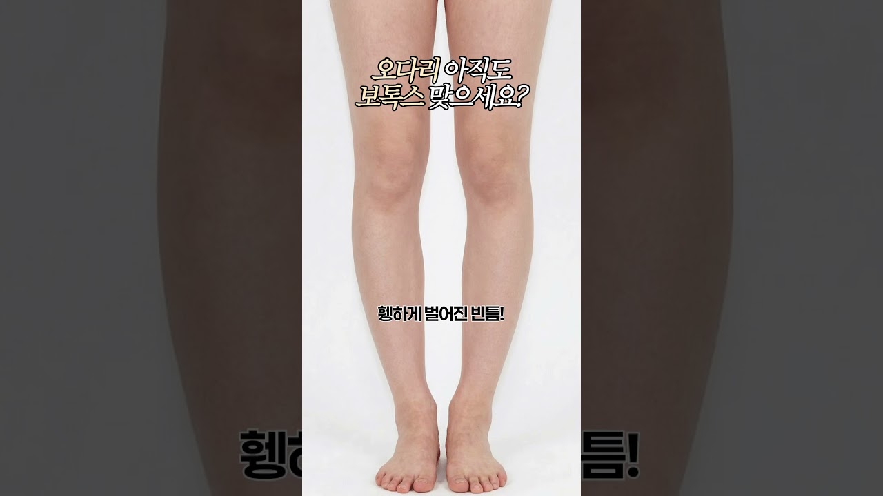 오다리 아직도 종아리 보톡스 맞으시는 거 아니죠?