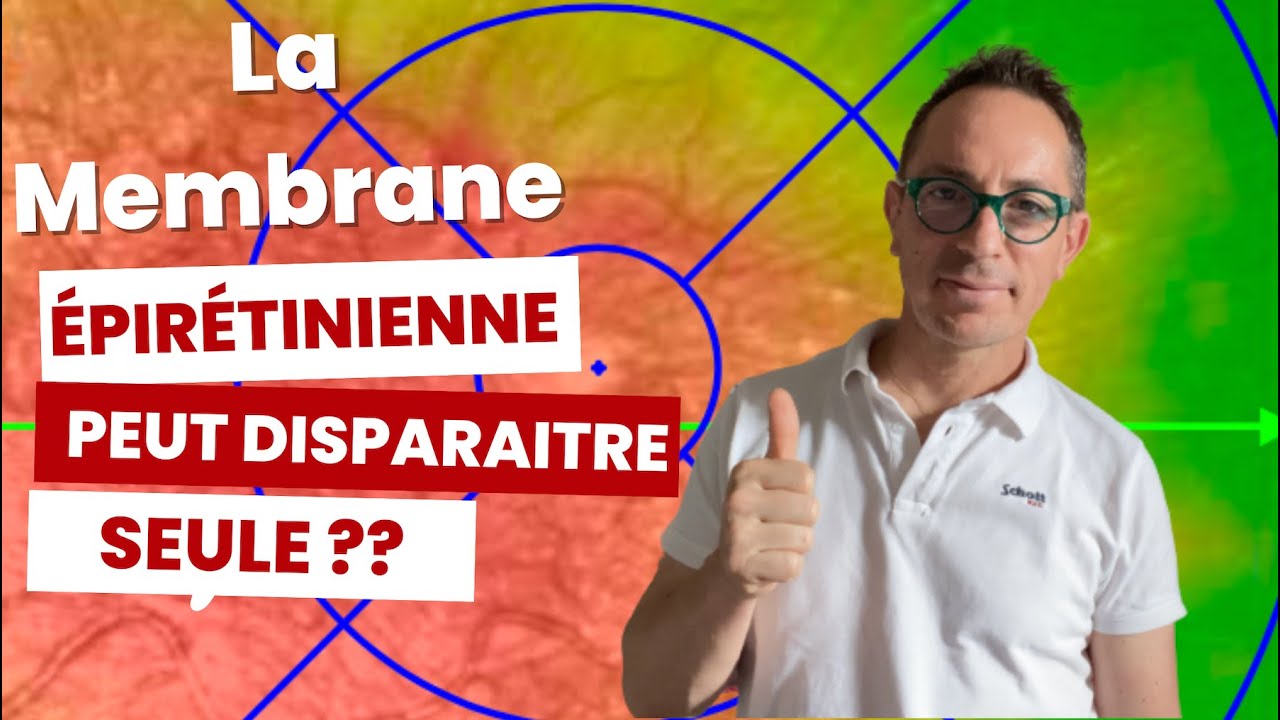 La MER (Membrane épirétinienne), Causes et traitement (Maladie des yeux)