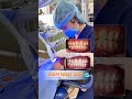 NỤ CƯỜI KHỎE ĐẸP - SẴN SÀNG CHO MỌI KHOẢNH KHẮC #hethongnhakhoaab #nhakhoahue #ưuđãi #Uudaitongquat