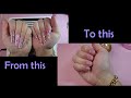 HOW TO REMOVE ACRYLIC NAILS